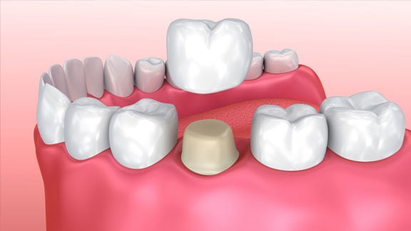 Cosmetic Dentistry Oak Park, IL